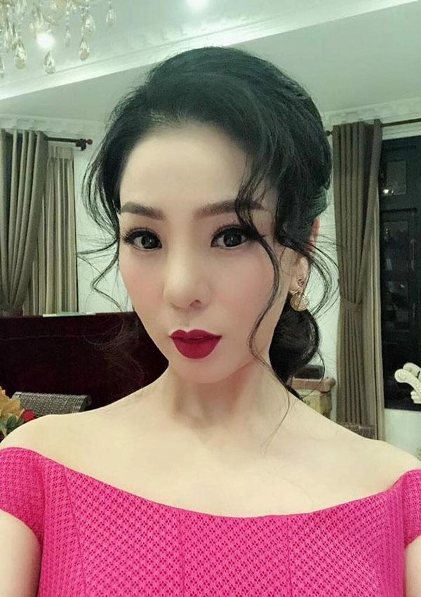 Tháo sụn mũi vì sắp hoại tử nhưng lệ quyên lại được người hâm mộ khen hết lời