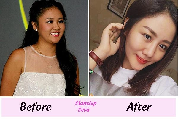 Thay đổi diện mạo chóng mặt những sao việt này dính nghi vấn độn cằm v line