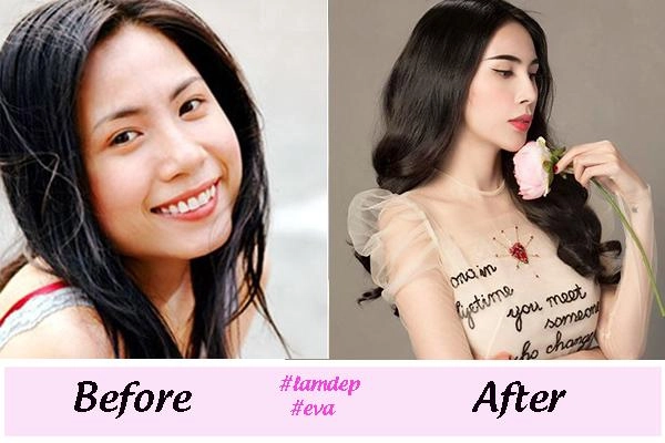 Thay đổi diện mạo chóng mặt những sao việt này dính nghi vấn độn cằm v line