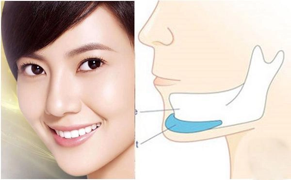 Thay đổi diện mạo chóng mặt những sao việt này dính nghi vấn độn cằm v line