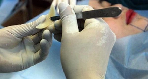 Thay đổi diện mạo chóng mặt những sao việt này dính nghi vấn độn cằm v line