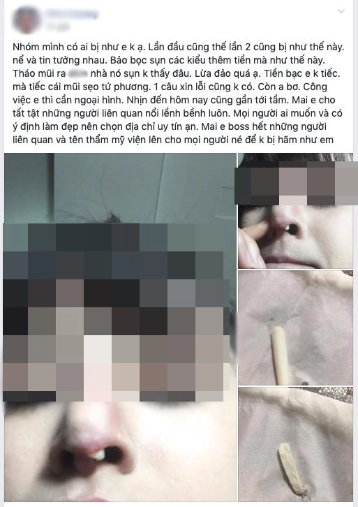 Thế giới bây giờ đảo điên thật rồi tưởng lòi sụn sau nâng mũi tháo ra lại chẳng phải sụn