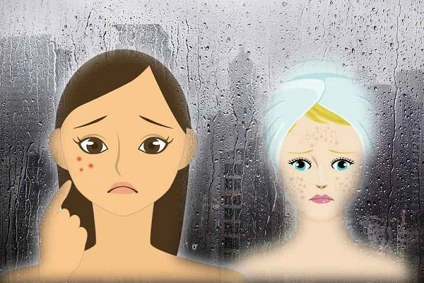 Thời tiết mát mẻ đừng tưởng mụn sẽ không bùng nổ lầm to đấy
