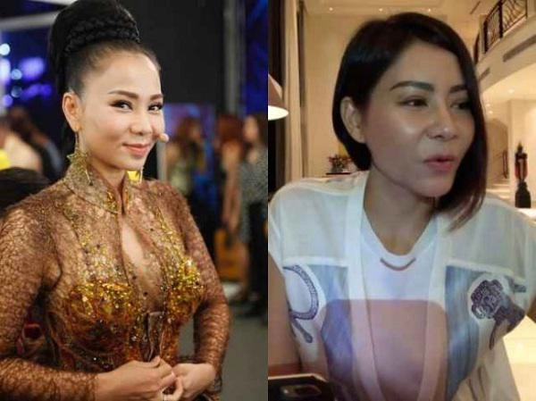 Thu minh nghi dùng dao kéo khi xuất hiện với chiếc mũi khác lạ