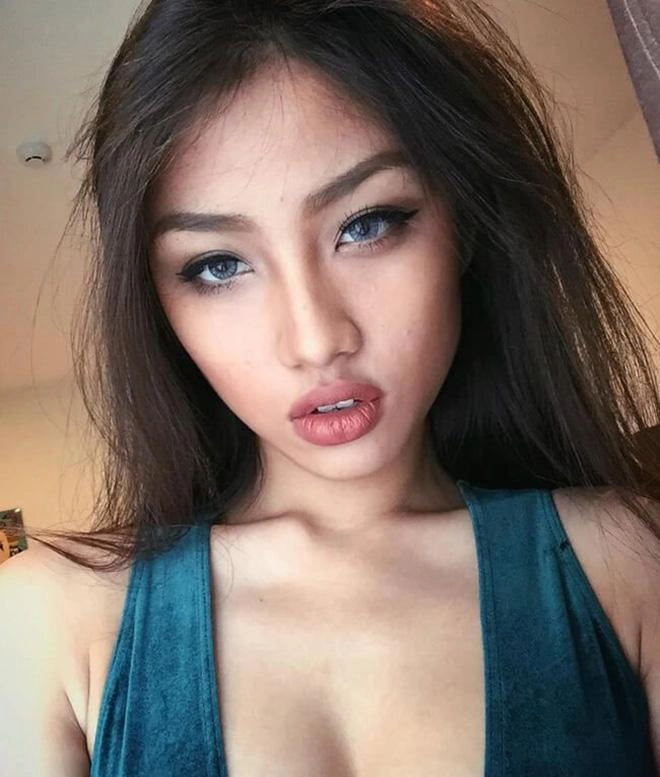 Tiêm filler làm dày môi và những dáng môi hot nhất năm 2018 các nàng cần cập nhật