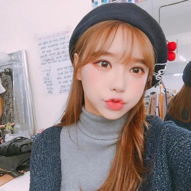 Tiêm filler làm dày môi và những dáng môi hot nhất năm 2018 các nàng cần cập nhật
