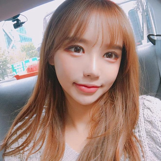 Tiêm filler làm dày môi và những dáng môi hot nhất năm 2018 các nàng cần cập nhật