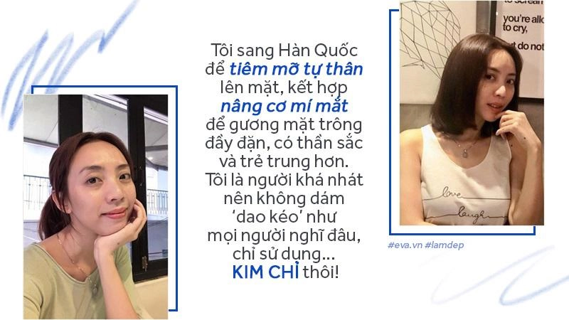 Tiêm filler xóa nhăn độn cằm tạo dáng mặt đang dần trở thành cơn sốt oanh tạc showbiz