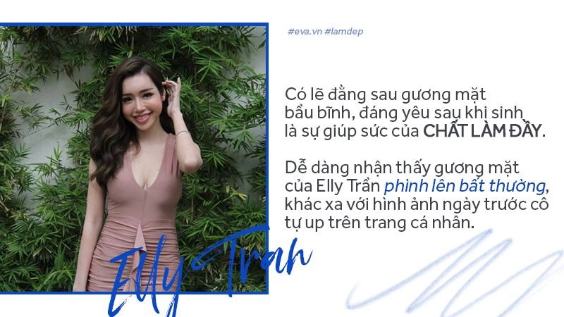 Tiêm filler xóa nhăn độn cằm tạo dáng mặt đang dần trở thành cơn sốt oanh tạc showbiz
