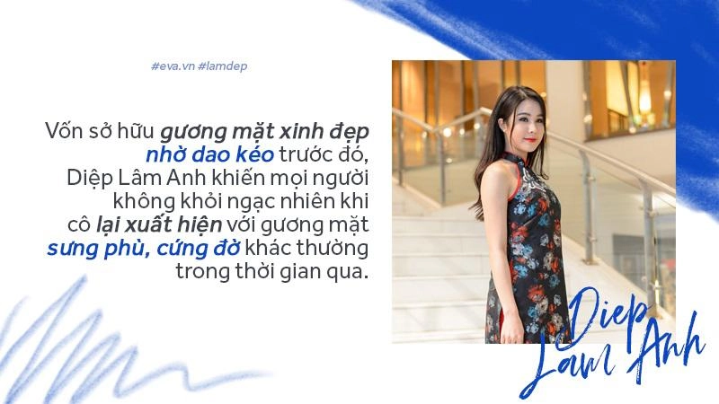 Tiêm filler xóa nhăn độn cằm tạo dáng mặt đang dần trở thành cơn sốt oanh tạc showbiz