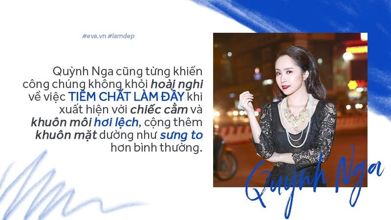 Tiêm filler xóa nhăn độn cằm tạo dáng mặt đang dần trở thành cơn sốt oanh tạc showbiz