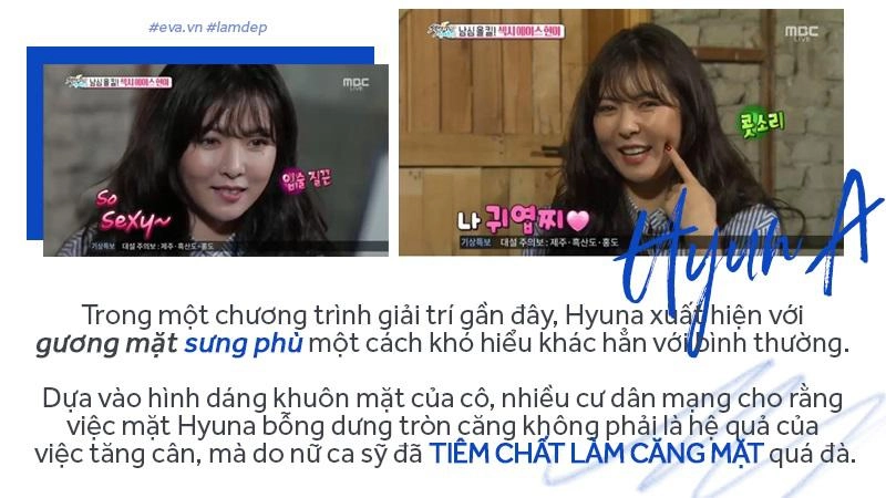 Tiêm filler xóa nhăn độn cằm tạo dáng mặt đang dần trở thành cơn sốt oanh tạc showbiz