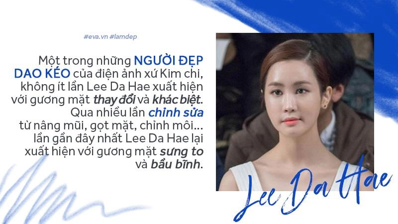 Tiêm filler xóa nhăn độn cằm tạo dáng mặt đang dần trở thành cơn sốt oanh tạc showbiz