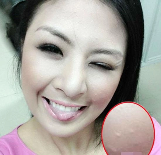 Tiểu vy mai phương thuý và loạt mỹ nhân dù make-up kỹ càng vẫn lộ làn da chi chít mụn