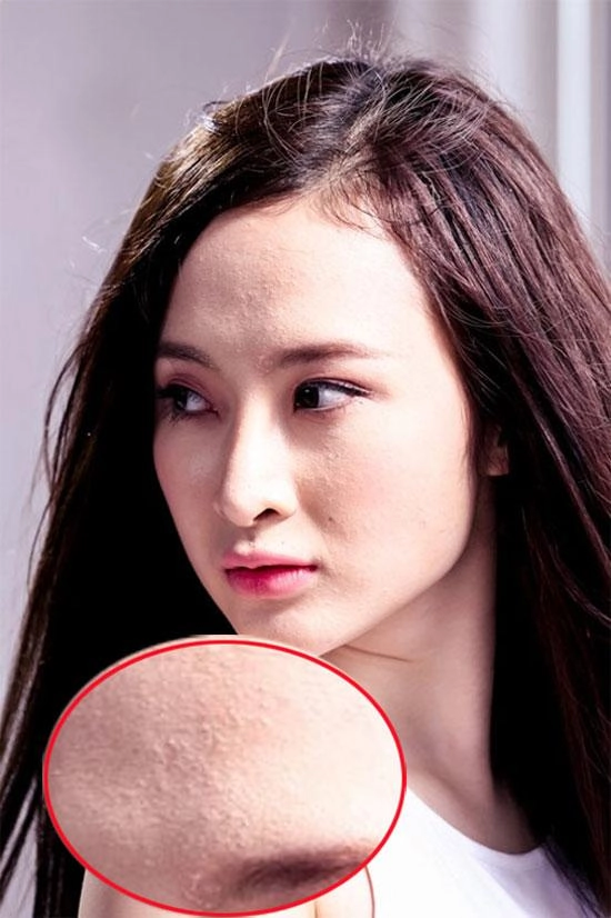 Tiểu vy mai phương thuý và loạt mỹ nhân dù make-up kỹ càng vẫn lộ làn da chi chít mụn