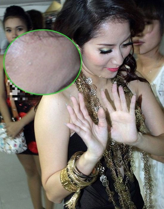 Tiểu vy mai phương thuý và loạt mỹ nhân dù make-up kỹ càng vẫn lộ làn da chi chít mụn