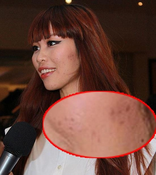 Tiểu vy mai phương thuý và loạt mỹ nhân dù make-up kỹ càng vẫn lộ làn da chi chít mụn