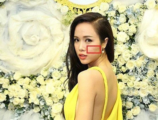 Tiểu vy mai phương thuý và loạt mỹ nhân dù make-up kỹ càng vẫn lộ làn da chi chít mụn