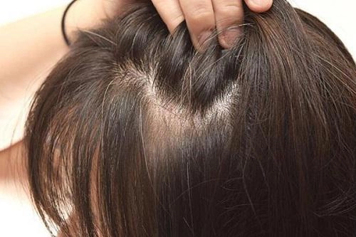 Trị tóc bạc sớm nhờ công thức nhuộm đen bằng khế chua và khoai tây rẻ như cho
