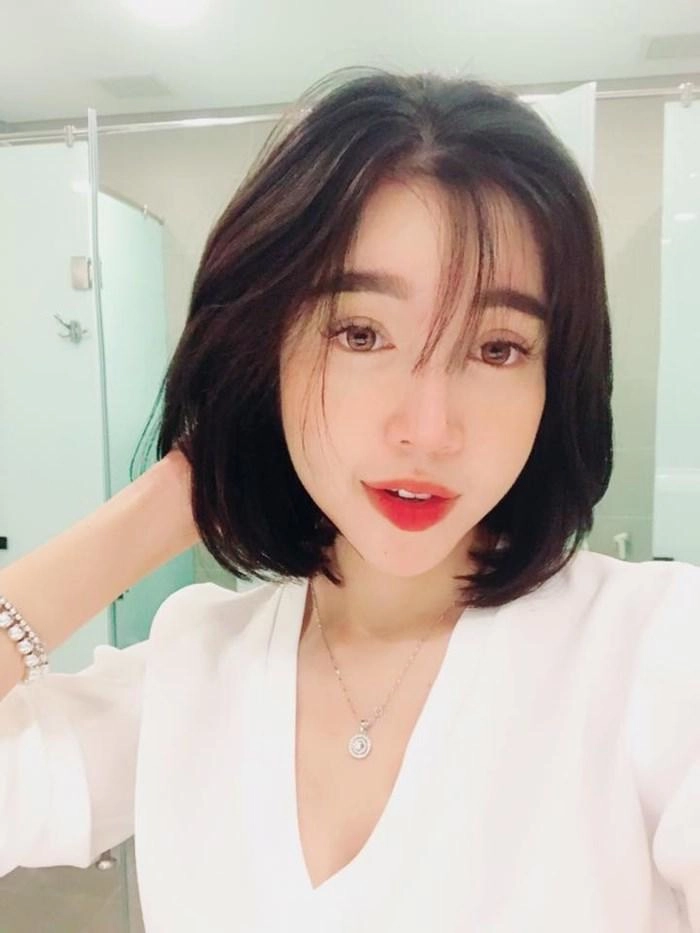 Trong khi elly trần lộ mặt sưng vù văn mai hương lại gây hoảng hốt vì cằm tam giác nhọn