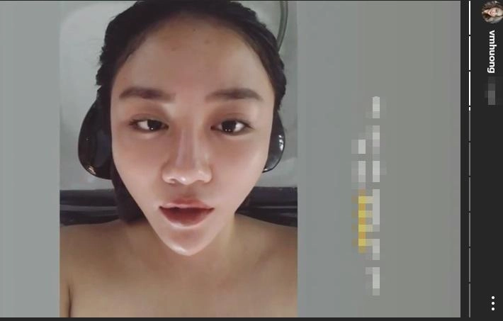 Trong khi elly trần lộ mặt sưng vù văn mai hương lại gây hoảng hốt vì cằm tam giác nhọn