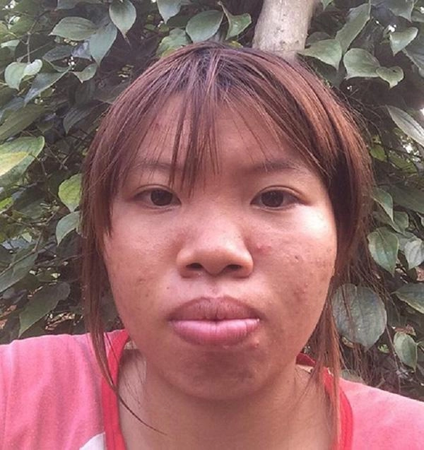 Từng đập đi xây lại cả khuôn mặt liệu đây có phải cái kết buồn cho phượng thị nở