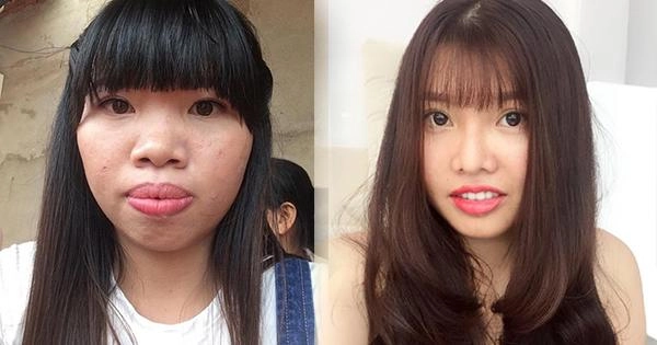 Từng đập đi xây lại cả khuôn mặt liệu đây có phải cái kết buồn cho phượng thị nở