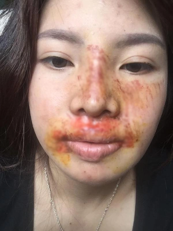 Từng đập đi xây lại cả khuôn mặt liệu đây có phải cái kết buồn cho phượng thị nở