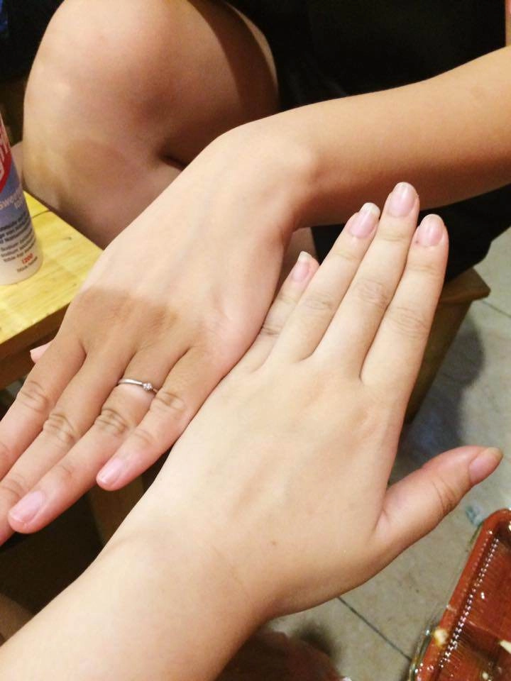 Tuyển tập ác mộng mùa hè dưỡng da cả một đời để rồi bị cháy nắng đến không thương tiếc