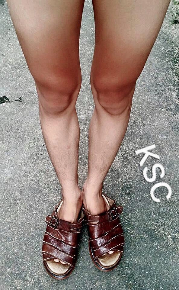 Tuyển tập ác mộng mùa hè dưỡng da cả một đời để rồi bị cháy nắng đến không thương tiếc