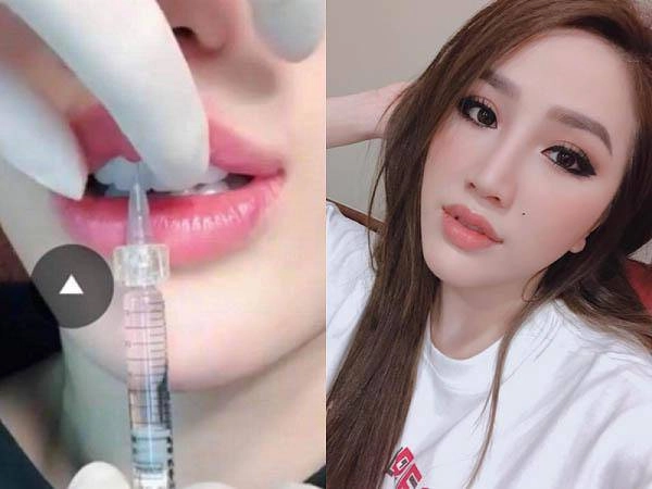 Xém chút không nhận ra bảo thy vì gương mặt quá khác lạ như phẫu thuật hỏng