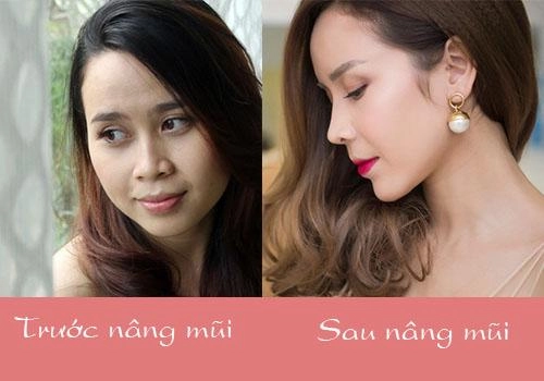 Xuất hiện với diện mạo khác lạ phải chăng lưu hương giang chạy theo trào lưu độn trán