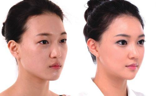 Xuất hiện với diện mạo khác lạ phải chăng lưu hương giang chạy theo trào lưu độn trán