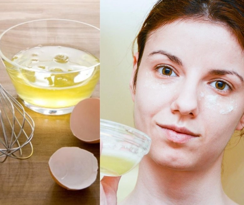 5 nguyên liệu là bài thuốc đánh bay mụn trên da không tốn tiền đi spa mà hiệu quả vượt trội