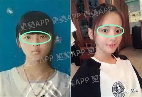 cô gái đẹp nhất trung quốc bất ngờ lộ mặt nguyên bản xấu xí