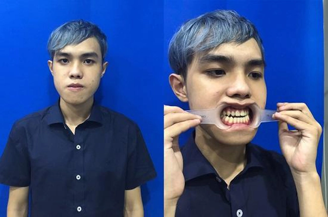 Cơ hội thay đổi cuộc đời với vé phẫu thuật thẩm mỹ 500 triệu đồng