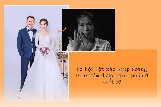Cơ hội thay đổi cuộc đời với vé phẫu thuật thẩm mỹ 500 triệu đồng