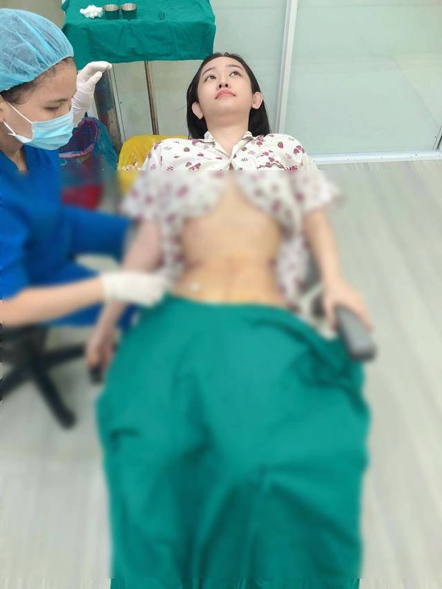 Đã hút 2kg mỡ thừa thúy vi vẫn bị cđm phát hiện dùng app chỉnh eo lệch cả rốn