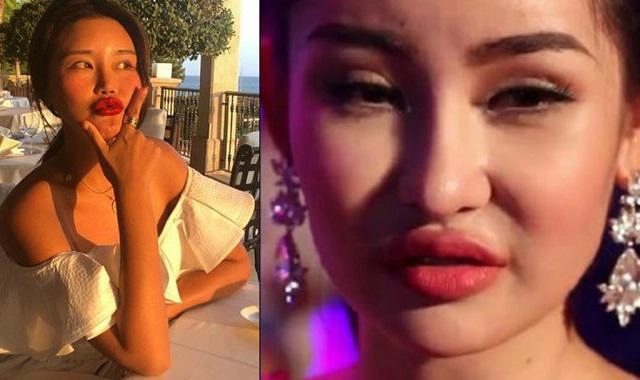 Đã tìm ra phiên bản thẩm mỹ hỏng môi tều giống hệt lê âu ngân anh không ai khác là