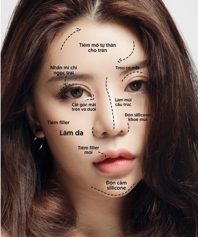 Đã tìm ra phiên bản thẩm mỹ hỏng môi tều giống hệt lê âu ngân anh không ai khác là