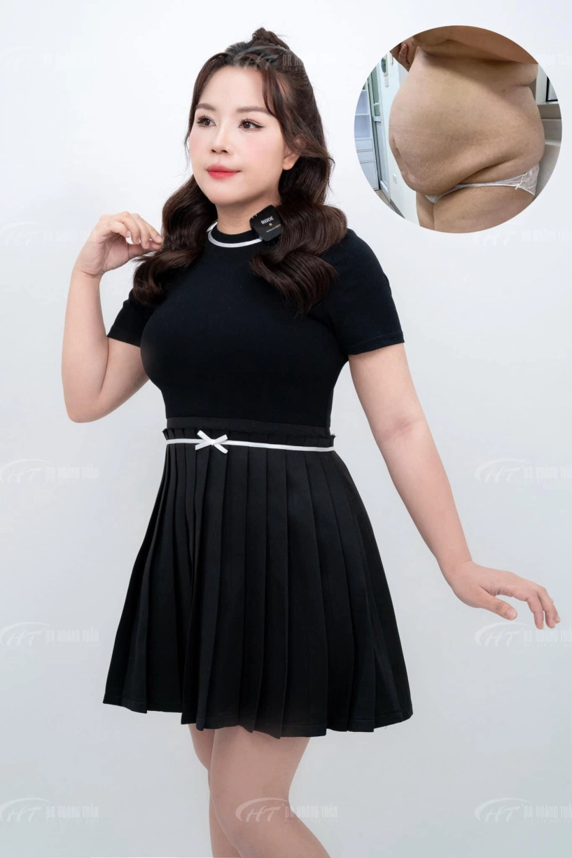 Hạnh phúc vỡ òa của bà mẹ nội trợ nặng gần 90kg khi trở về diện đồ size s