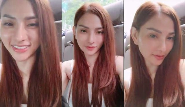 Hôm trước tư vấn thẩm mỹ nay thu thủy xúi cánh mày râu dao kéo khiến cđm ngỡ ngàng