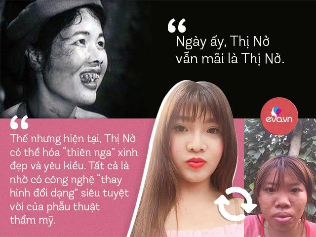 Khi dao kéo đổ bộ ai cũng có thể hoá mỹ nhân nhưng sau tất cả có chắc bình yên