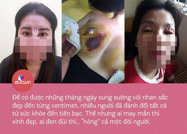 Khi dao kéo đổ bộ ai cũng có thể hoá mỹ nhân nhưng sau tất cả có chắc bình yên