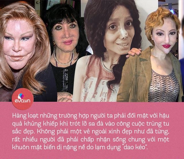Khi dao kéo đổ bộ ai cũng có thể hoá mỹ nhân nhưng sau tất cả có chắc bình yên