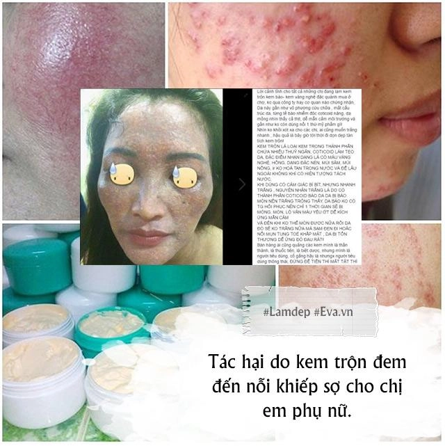 Khi kem trộn lên ngôi tiếc nuối vị thế khuynh đảo đông dương một thời của mỹ phẩm việt