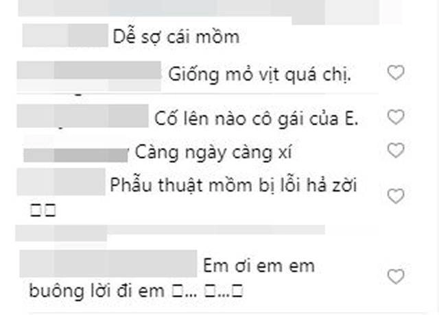 Khoe ảnh đẹp nhưng bị chê môi tều như mỏ vịt linh chi lập tức đáp trả gay gắt
