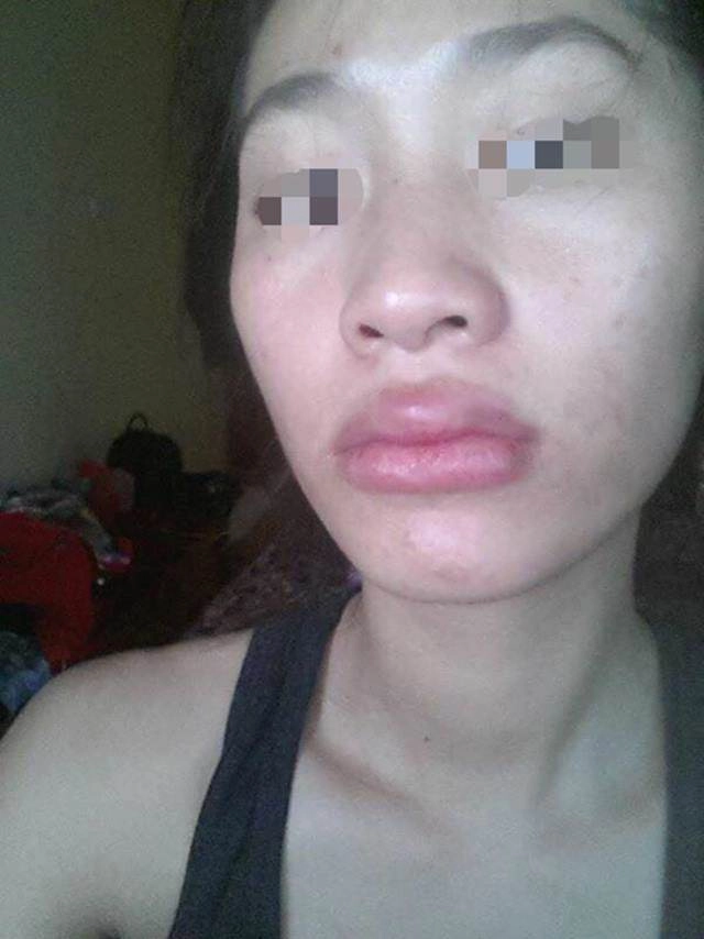 Khoe ảnh đẹp nhưng bị chê môi tều như mỏ vịt linh chi lập tức đáp trả gay gắt