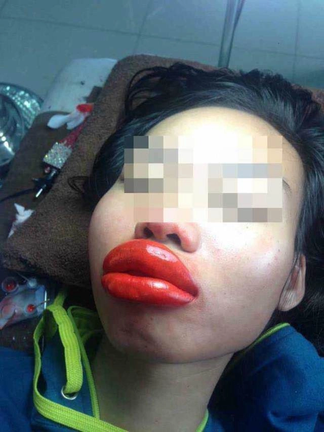 Khoe ảnh đẹp nhưng bị chê môi tều như mỏ vịt linh chi lập tức đáp trả gay gắt