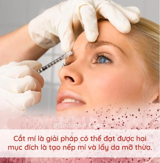 Làm đẹp thế nào khi cứ mãi lẫn lộn nhấn mí với cắt mí đây là điều bạn cần biết